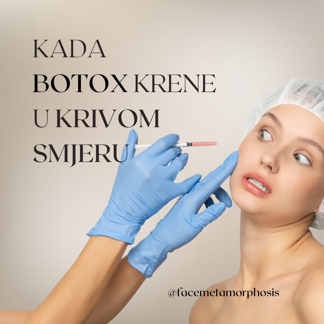 Što kad Botox krene u krivom smjeru?