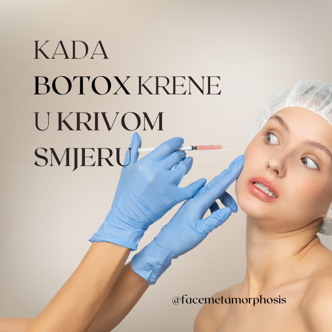 Što kad Botox krene u krivom smjeru?